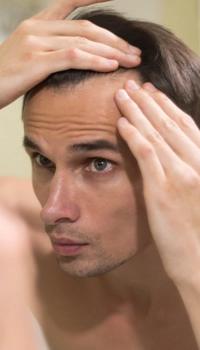 man looking at his hairline