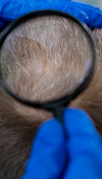close view of balding 