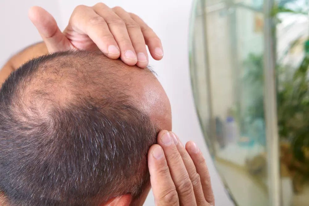 man looking at balding head